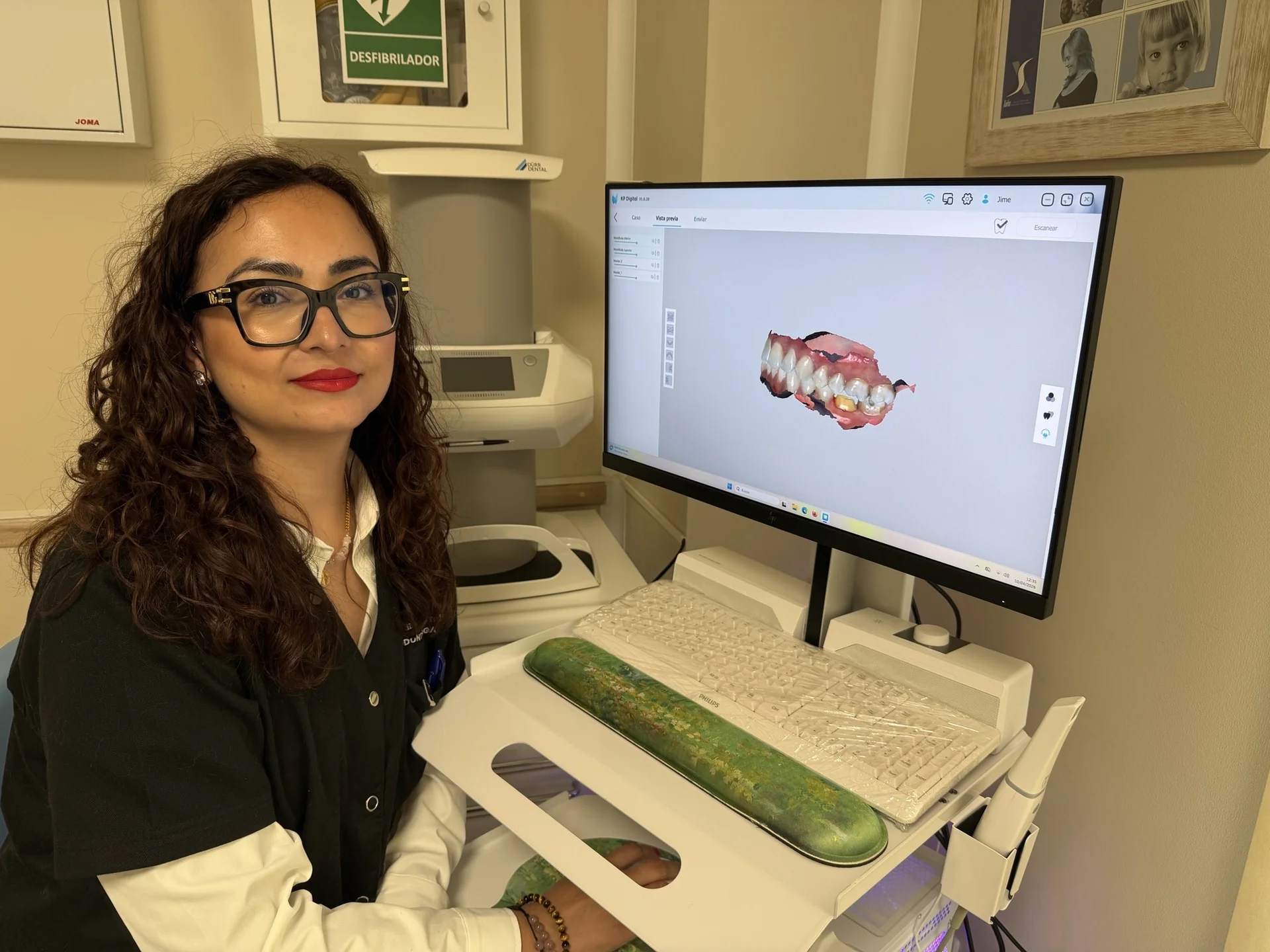 Escáner 3D de Sanident